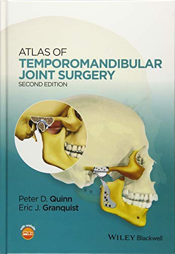 Atlas of Temporomandibular Joint Surgery