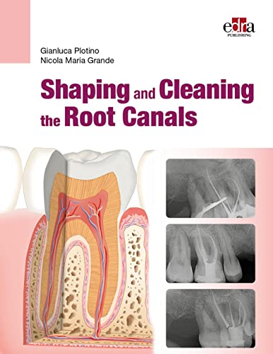 Shaping and Cleaning the Root Canal System