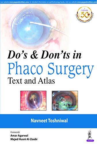 Dos &amp; Donts in Phaco Surgery: Text and Atlas