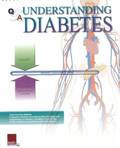 Understanding Diabetes Flip Chart