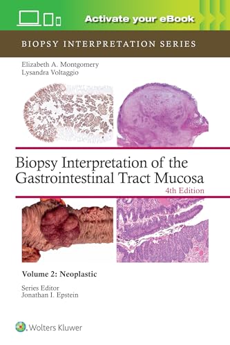 Biopsy Interpretation of the Gastrointestinal Tract Mucosa Volume 2 : Neoplastic: Print + eBook with Multimedia : 2