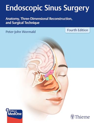 Endoscopic Sinus Surgery: Anatomy