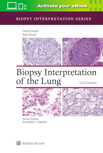 Biopsy Interpretation of the Lung