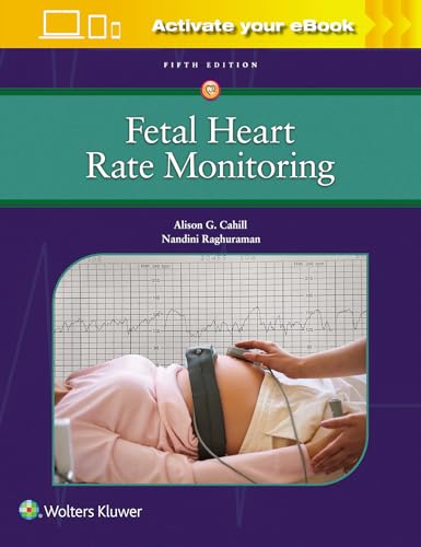 Fetal Heart Rate Monitoring