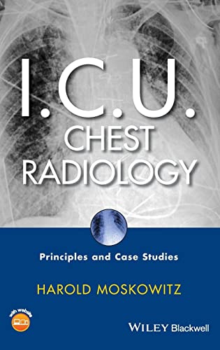 I.C.U. Chest Radiology: Principles and Case Studies