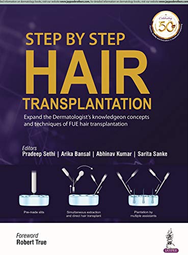 Book cover: “Step by Step Hair Transplantation” with surgical tool illustrations.
