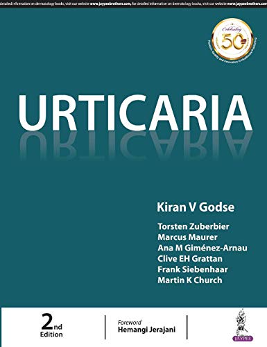 Book cover for "Urticaria" by Kiran V Godse, 2nd edition.