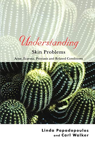 Understanding Skin Problems: Acne