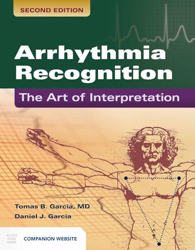 Arrhythmia Recognition: the Art of Interpretation : The Art of Interpretation