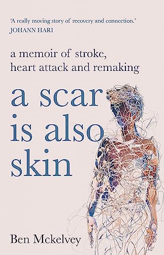 A Scar is Also Skin : A memoir of stroke, heart attack and remaking