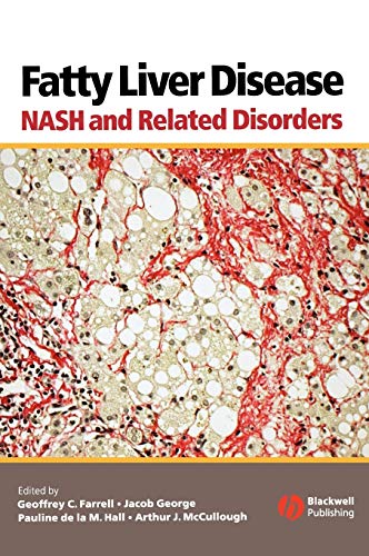 Fatty Liver Disease: NASH and Related Disorders