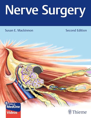 Nerve Surgery