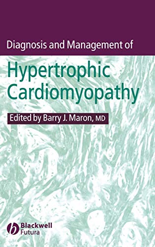 Diagnosis and Management of Hypertrophic Cardiomyopathy: Sudden Death Prevention