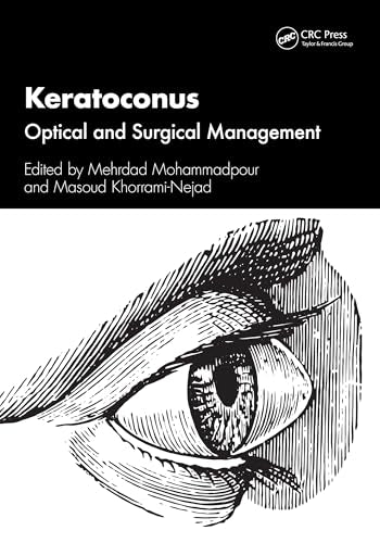 Keratoconus : Optical and Surgical Management