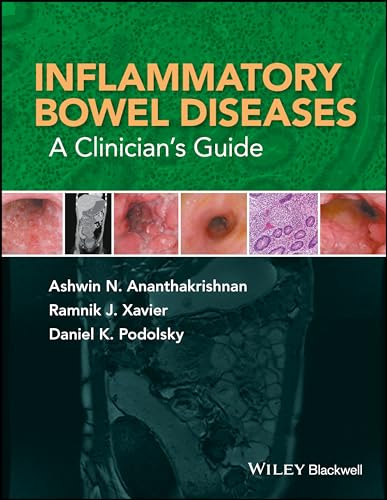 Inflammatory Bowel Diseases - a Clinicians Guide