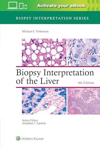 Biopsy Interpretation of the Liver (Biopsy Interpretation Series)