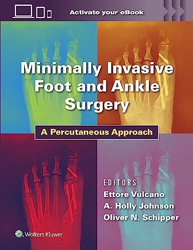 Minimally Invasive Foot and Ankle Surgery : A Percutaneous Approach