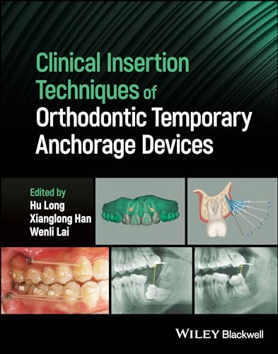Clinical Insertion Techniques of Orthodontic Temporary Anchorage Devices