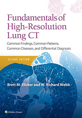 Fundamentals of High-Resolution Lung CT: Common Findings, Common Patterns, Common Diseases and Differential Diagnosis (Pocket Notebook)