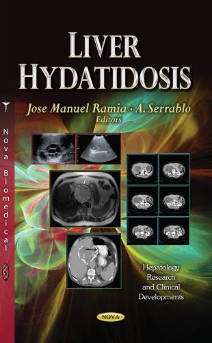 Liver Hydatidosis