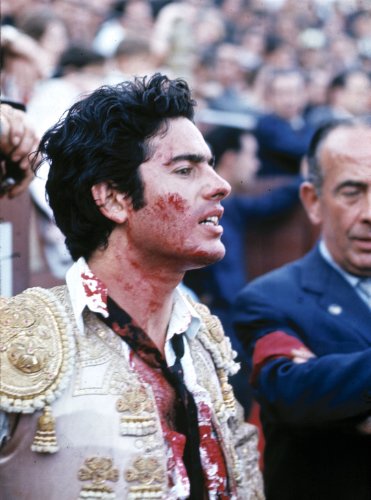 Injured matador with bloodied face looks upward during a bullfight.