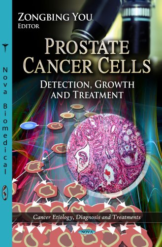 Prostate Cancer Cells