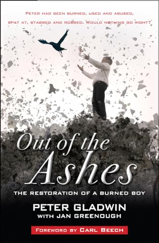 Out of the Ashes: The restoration of a burned boy