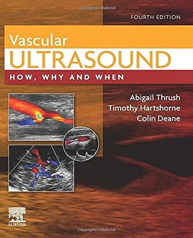 Vascular Ultrasound: How, Why and When, 4e