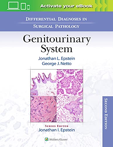 Differential Diagnoses in Surgical Pathology: Genitourinary     System