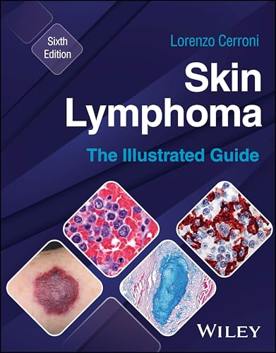 Book cover: “Skin Lymphoma: The Illustrated Guide,” sixth edition, with medical images.
