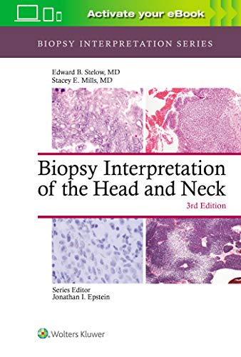 Biopsy Interpretation of the Head and Neck