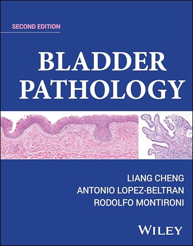 Bladder Pathology