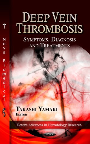 Deep Vein Thrombosis
