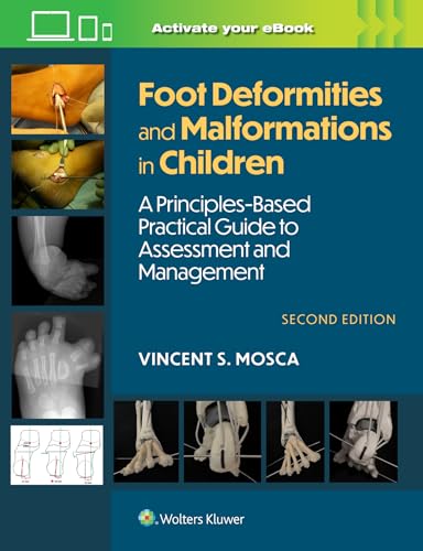 Foot Deformities and Malformations in Children : A Principles-Based, Practical Guide to Assessment and Management: Print + eBook with Multimedia