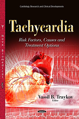 Tachycardia