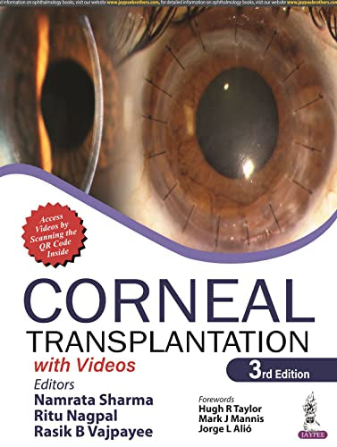 Corneal Transplantation: with Videos