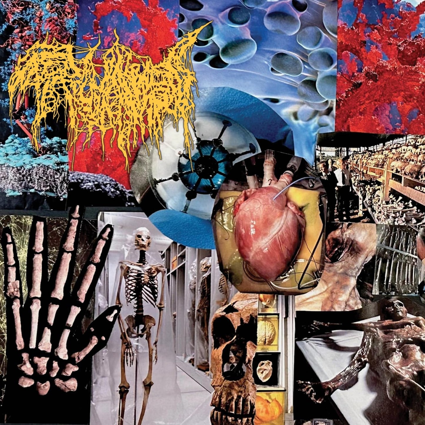 Trichomoniasis - Harvest Of The Killing Fields [CD]