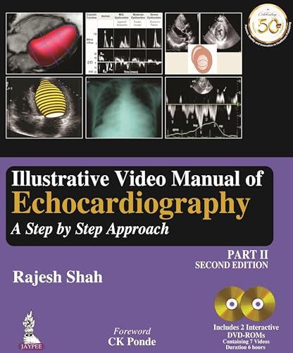 Illustrative Video Manual of Echocardiography: A Step by Step Approach - Part 2