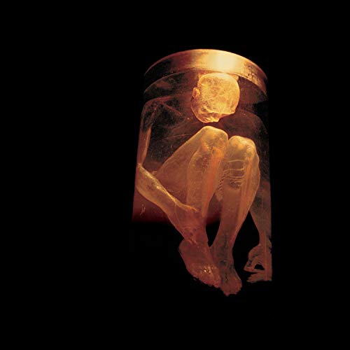 Fetus in a jar, illuminated with warm orange light, dark background.