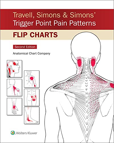 Anatomy flip chart showing trigger point pain patterns on a human body.
