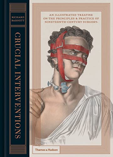 Book cover depicting a 19th-century surgical patient with head restraints.