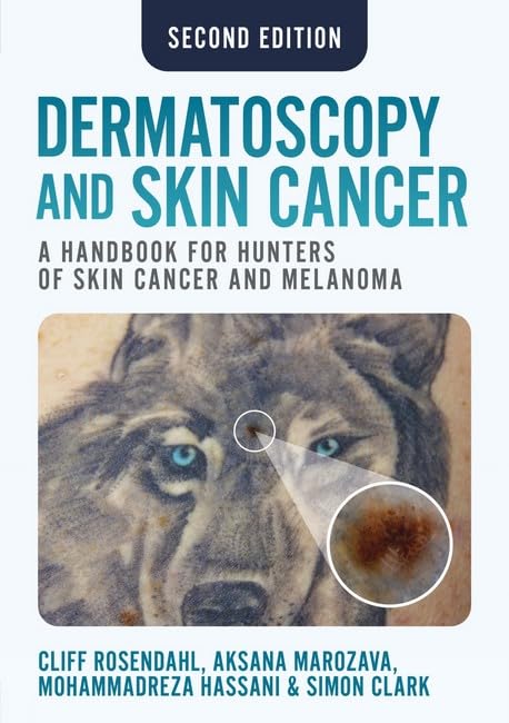 Book cover featuring a wolf’s eye with a magnified skin lesion image.