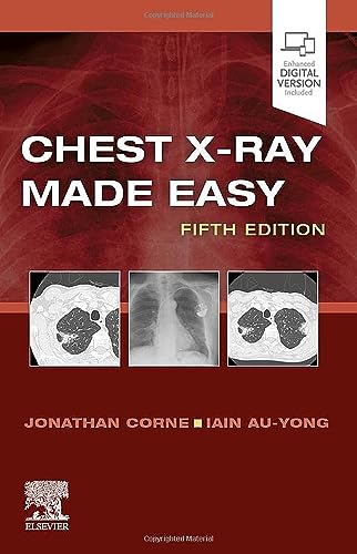 Book cover: "Chest X-Ray Made Easy" with example X-ray images.