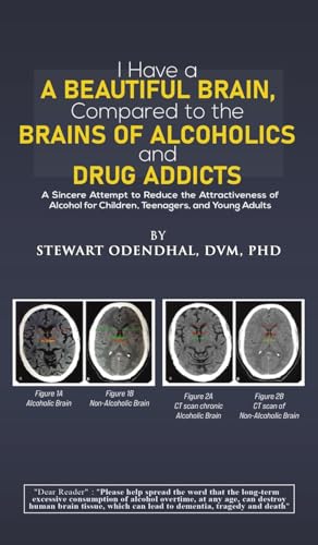 Book cover with brain scans comparing alcoholic and non-alcoholic brains.