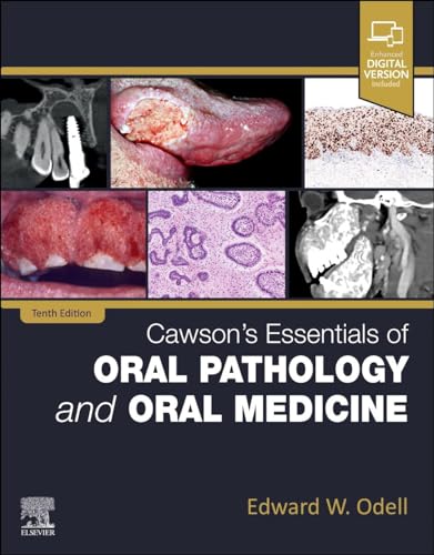 Textbook cover: “Cawson’s Essentials of Oral Pathology and Oral Medicine,” tenth edition.
