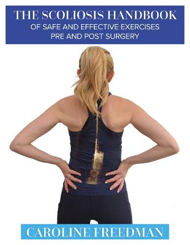 Book cover showing a woman’s back with a scoliosis curve illustration.