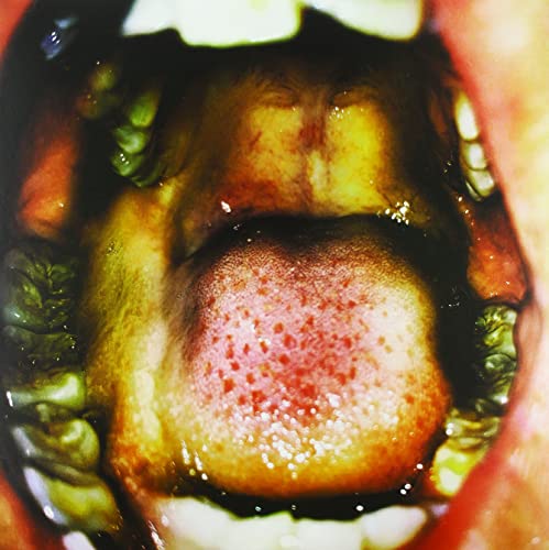 Close-up view inside an open mouth showing teeth, tongue, and throat.