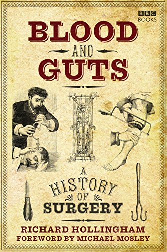 Book cover depicting historical surgery scenes and medical instruments.