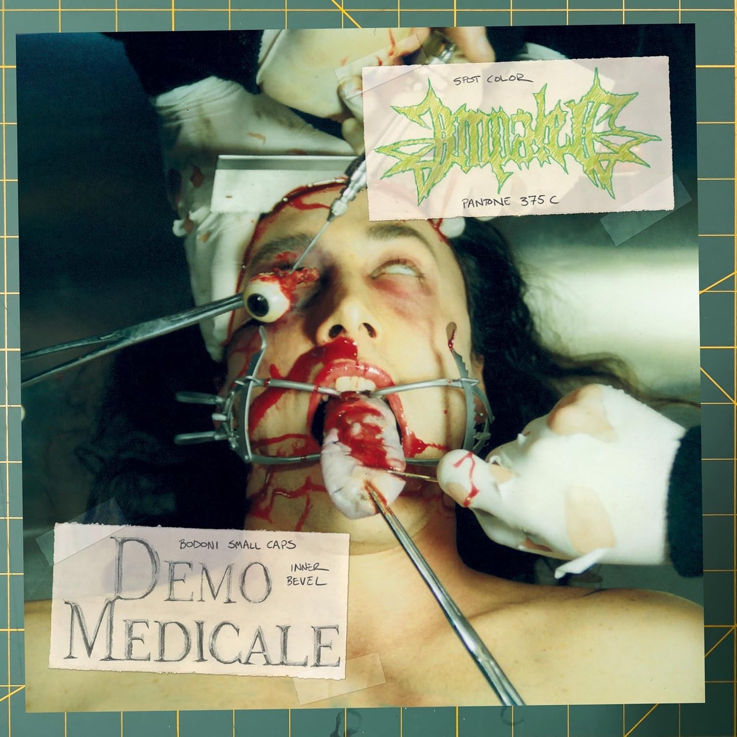 Disturbing album cover depicting a graphic surgical scene with text overlays.