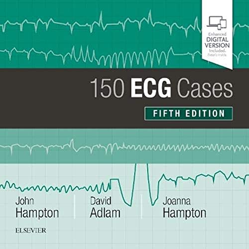 Book cover with ECG waveforms, title “150 ECG Cases,” and author names.